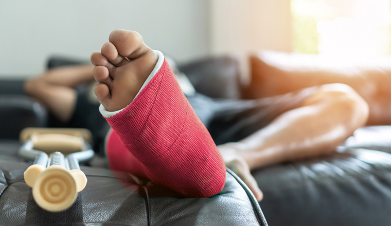 Bone fracture foot and leg on male patient with splint cast and crutches during surgery rehabilitation and orthopaedic recovery staying at home