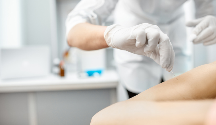 Close-up of the acupuncture medical treatment with special needles